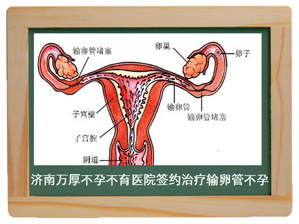 通草的功效与作用能通输卵管堵塞,诠释解析落实_静态版39.850